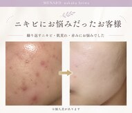 メナードフェイシャルサロン 中区平和