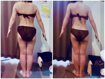 パーフェクトボディプレミアム 神戸三宮店(PERFECT BODY PREMIUM)/お客様 ビフォーアフター(19)