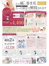 プチリリィ(Petit Lily)/見た目がきれいな巻き爪ケア