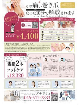 プチリリィ(Petit Lily)/見た目がきれいな巻き爪ケア