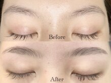 アイル(eye'll)/Hollywood brow lift