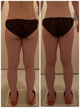 クイーンズ ピュア 長崎店(Queen's Pure)/むっちり下半身お悩み解消コース