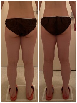 クイーンズ ピュア 長崎店(Queen's Pure)/むっちり下半身お悩み解消コース