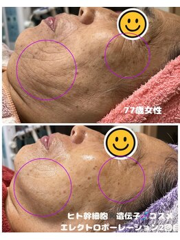 ローズ 下松(ROSE)/ヒト幹細胞美容液と遺伝子コスメ