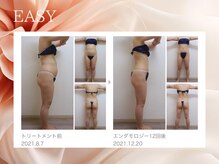 イージー(EASY)/