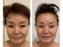 ドクターボディクリスタル(Dr.Body Crystal)/70代