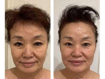 ドクターボディクリスタル(Dr.Body Crystal)/70代