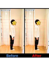 のと整体 金沢本院/ストレートネックが整う