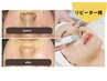 再来【鼻の黒ずみごっそり】Tゾーン毛穴吸引＋鎮静パック+ドライヘッドスパ