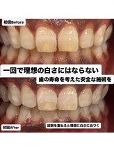 トータルビューティー エヌ プラス(total beauty n+)/初回体験での変化
