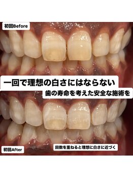 トータルビューティー エヌ プラス(total beauty n+)/初回体験での変化