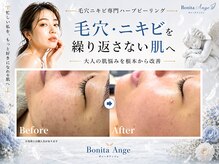 ボニータアンジュ 恵比寿(Bonita Ange)