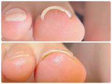 寺子屋ビューティーズ(寺子屋Beauty's)/フットネイルの前に整えませんか