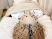 こじま 富雄団地接骨院/美容鍼