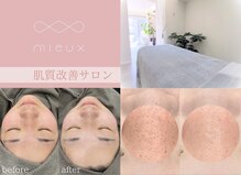 ミュー(mieux)