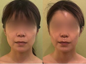 サロンハート(Salon Heart)/