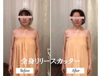 リノ(Lino)/全身リリースカッター◎