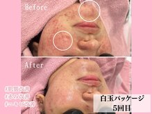 エン クリニカルラボ(E&N CLINICAL LABO)/白玉パッケージ☆