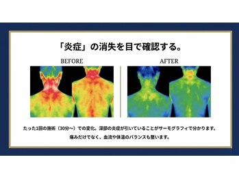 ココロ(COCORO)/現状と今後の説明