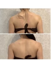 ダイヤモンドビューティー(Diamond Beauty)/背中徹底的にスッキリ