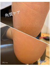 リトルツリー(little tree)/足裏角質ケア