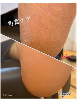 足裏角質ケア