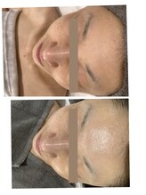 シェルビー(Cielbe.)/陶肌トリートメント