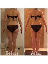 メイリー(MEILLI)/ハイパー＆detoxスリムハンド90