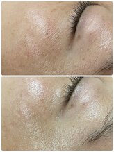 ヴェールココン(Veil Cocon)/目元の小ジワにアプローチ