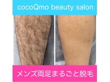 ココキューモオオズ(cocoQmo ozu)/ビフォーアフター
