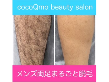 ココキューモオオズ(cocoQmo ozu)/ビフォーアフター