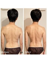 真(sin)/1回の施術変化