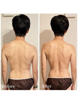 真(sin)/1回の施術変化