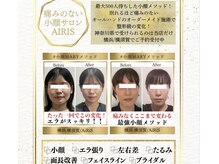 クラッシーオールイン タンゴイ(classy all in tanGoi)の雰囲気（MIKU限定のオールハンドの最新小顔技術！）