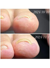 ルアナネイル(Luana Nail)/Heyswitch