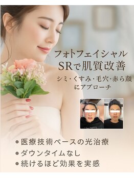 マイン(Mine)/本気で肌質改善したい方へ