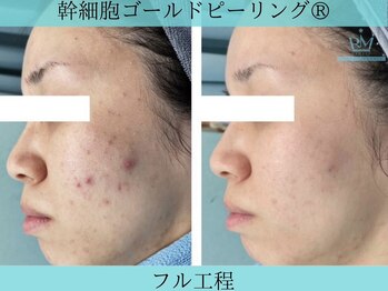 リメイククリニカルビューティー(Remake clinical beauty)/