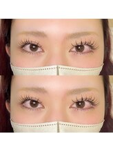 トゥービー(To Be)/バインドロック80束×下エク