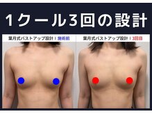 セブンシーズ 上野店(Seven Seas)/バストアップ/豊胸/東京都/上野