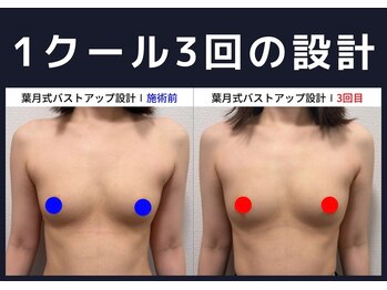 セブンシーズ 上野店(Seven Seas)/バストアップ/豊胸/東京都/上野