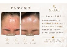 キューレット(CULET)の雰囲気(No.1セルマン艶玉/モデル、女優さんも通う実力派サロン!)