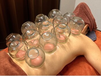 ボディストア/カッピングもあります♪