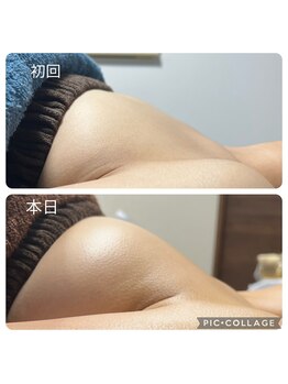 リボーン(REBORN)/ボンボンバスト