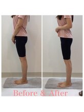 スタイルラボ高松/産後骨盤矯正の効果♪