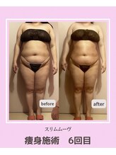 アコルデビューティー 恵比寿店(Acorde Beauty)/ビフォーアフター