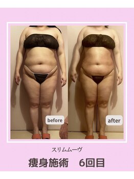 アコルデビューティー 恵比寿店(Acorde Beauty)/ビフォーアフター