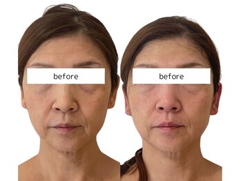 ソナ 大和西大寺院(SONA)/