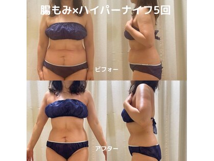 エン ボディアンドフェイシャル(En)の写真
