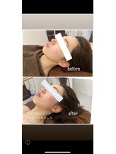 ボニート 堺東店(BONITO)/フェイシャルエルフィーノ