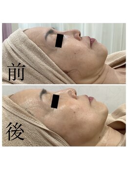 エスティ 京都店/ソニック